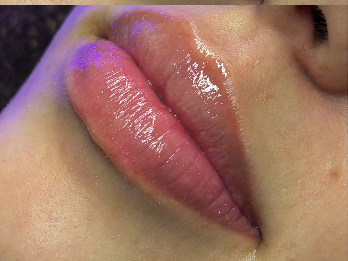 Hidragloss